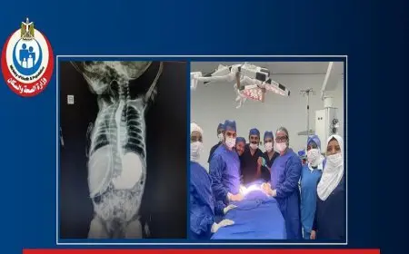 جراحة طارئة تنقذ رضيعة تبلغ من العمر 3 أيام من خطر الاختناق في مستشفى الخانكة