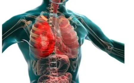 من الفيروس إلى التلف الرئوي: كيف يبدأ المرض الخفي في تدمير رئتيك؟