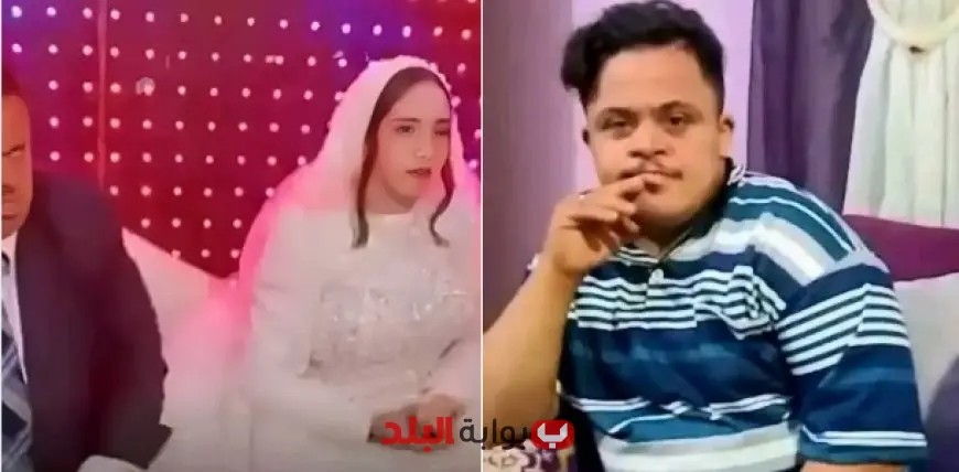 مفاجآت قانونية مثيرة: تفاصيل زواج عريس متلازمة داون من زوجة قاصر بعقد عرفي
