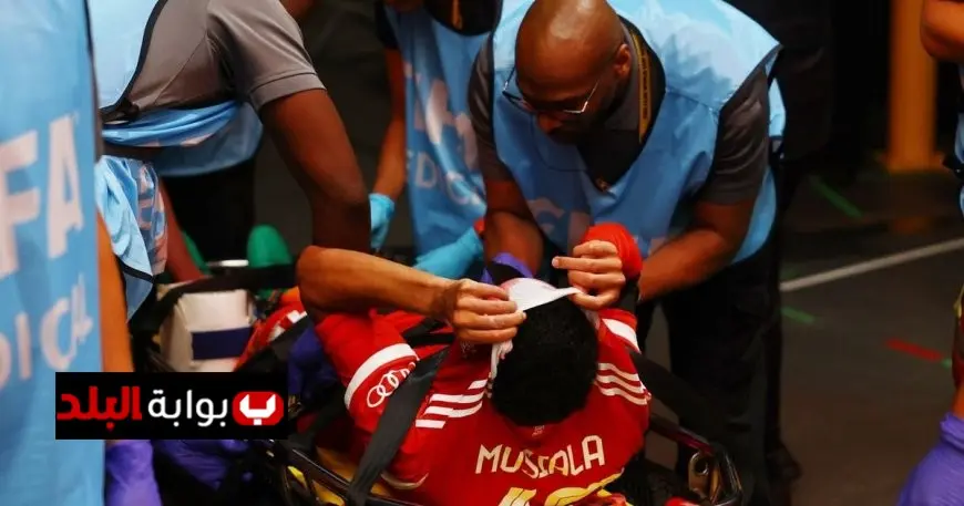 ناغلسمان: إصابة موسيالا تمثل صدمة قوية للمنتخب الألماني