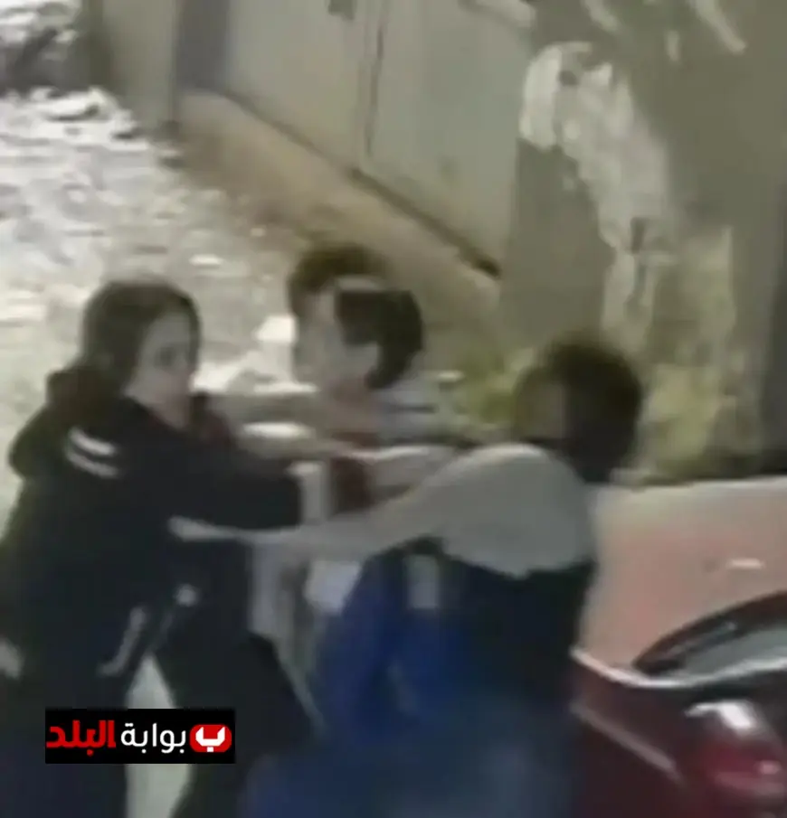 دانا تكشف تفاصيل الاعتداء عليها في شبرا الخيمة: “تعرضت لضرب مبرح بالطوب والكرسي وإصابات في وجهي”