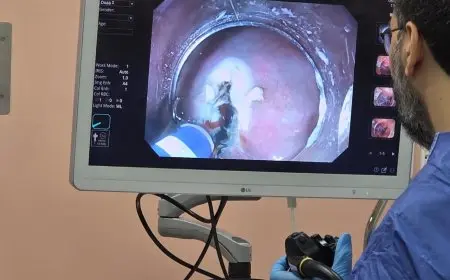 نجاح ريادي للذكاء الاصطناعي في مناظير القولون بمجمع السويس الطبي لأول مرة بالمحافظة