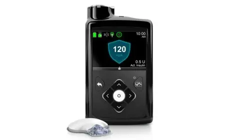 بنكرياس صناعي بتكلفة 400 ألف جنيه لإحداث ثورة في علاج السكر في مصر قريباً