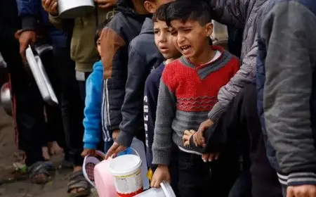 صحة غزة تكشف عن زيادة وفيات التجويع إلى 348 حالة تشمل 127 طفلاً