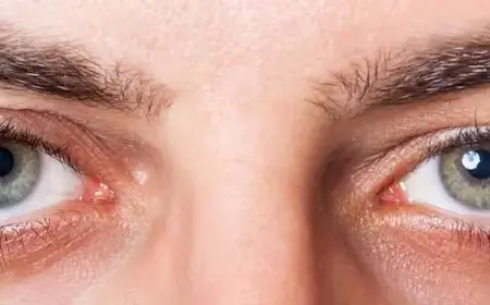 أهم مشاكل العين في الشتاء تبخر الدموع والحساسية الموسمية فيديو