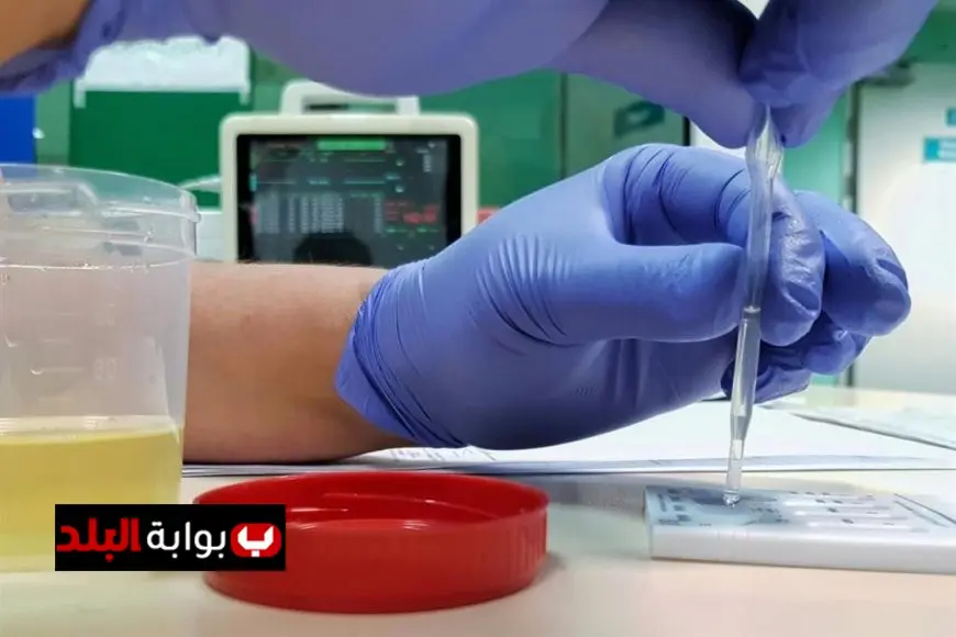 اكتشاف تعاطي المخدرات لدى 419 سائق حافلة مدرسية في خمس محافظات