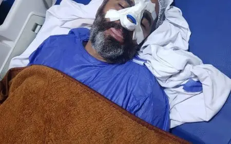 مشاجرة دامية بين لاعبي أبو قير والترسانة تتسبب في كسور وجروح والشواكيش يعتذرون عن الحادثة