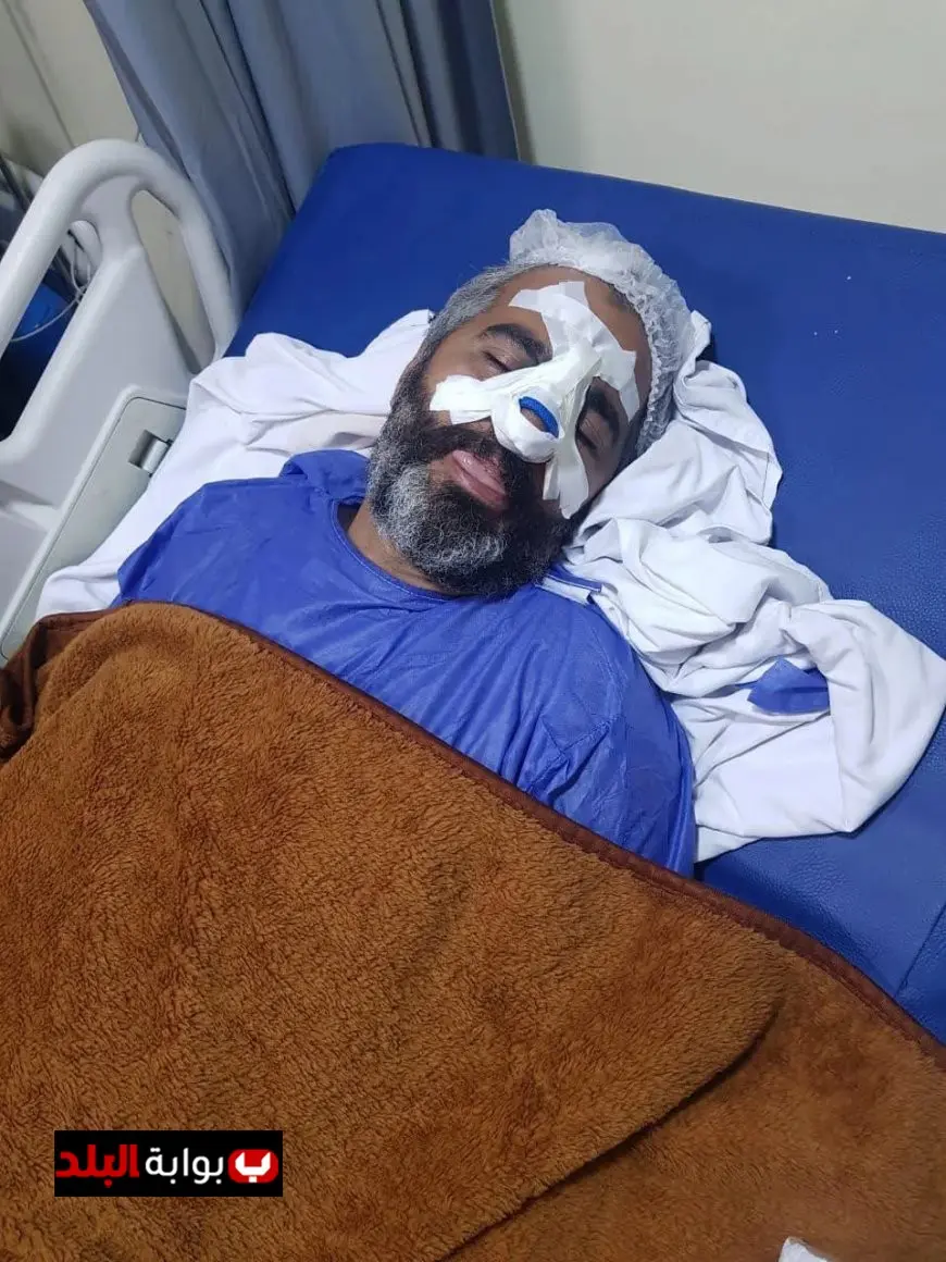 مشاجرة دامية بين لاعبي أبو قير والترسانة تتسبب في كسور وجروح والشواكيش يعتذرون عن الحادثة