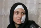 نهى ضحية العنف في دار السلام تكشف معاناتها بعد 12 سنة من الإساءة وجروح شوهت وجهها بـ 80 غرزة
