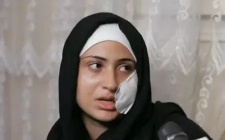 نهى ضحية العنف في دار السلام تكشف معاناتها بعد 12 سنة من الإساءة وجروح شوهت وجهها بـ 80 غرزة
