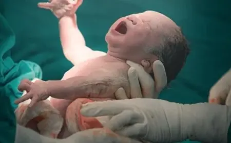 تحذيرات طبية تكشف تأثير الولادة القيصرية على حرمان الطفل من البكتيريا المفيدة