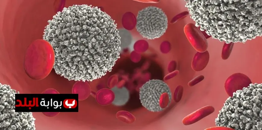 طرق فعالة لتجنب الإصابة بسرطان عنق الرحم