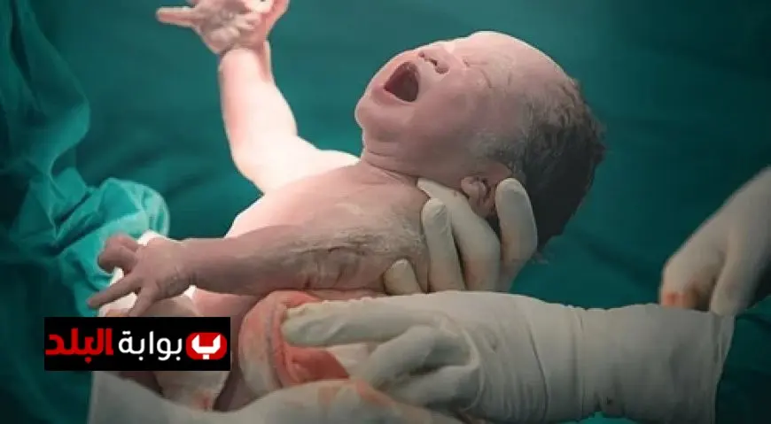 تحذيرات طبية تكشف تأثير الولادة القيصرية على حرمان الطفل من البكتيريا المفيدة
